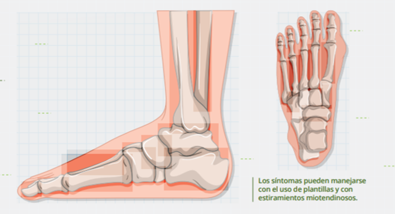 El detalle está en los pies: ¿Cómo son los championes